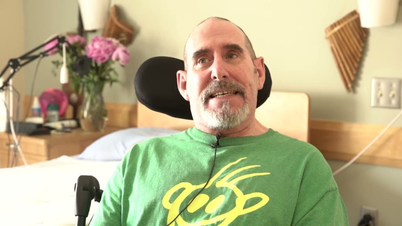 Paralysis after covid jab